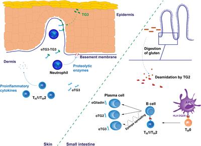 Missing Insight Into T and B Cell Responses in Dermatitis Herpetiformis